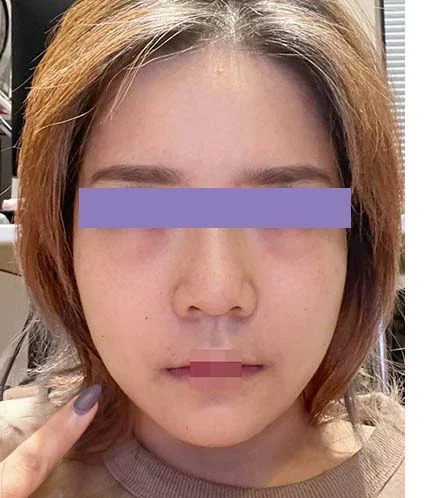 After
