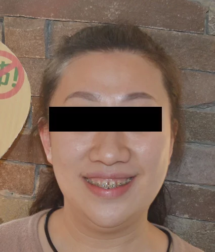 After