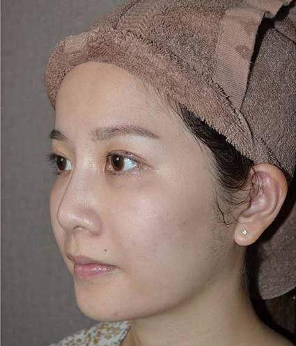 Before