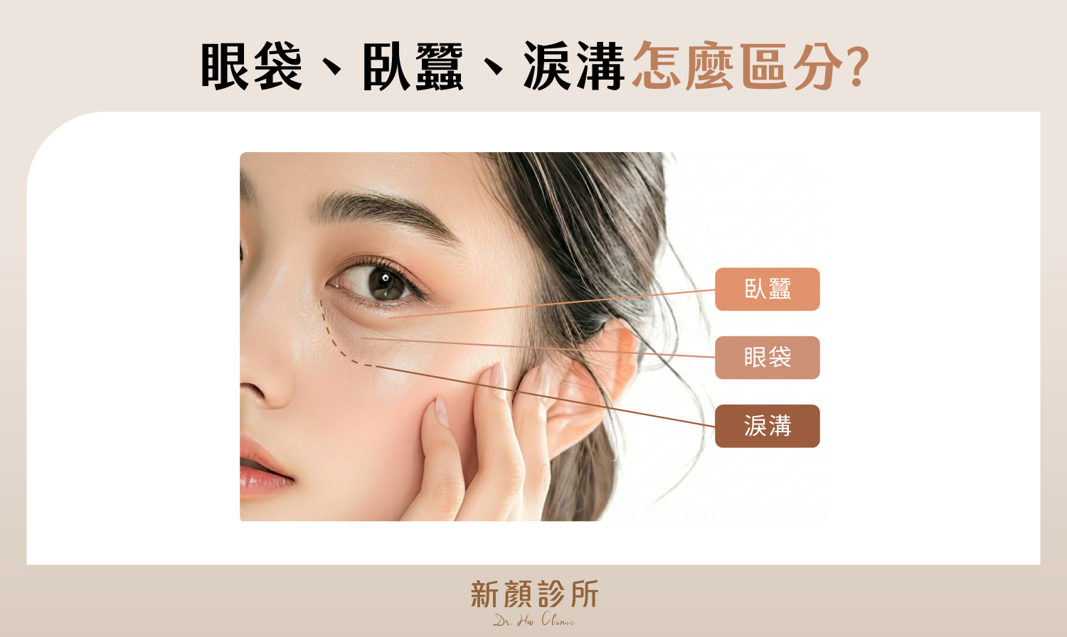 眼袋臥蠶淚溝區分