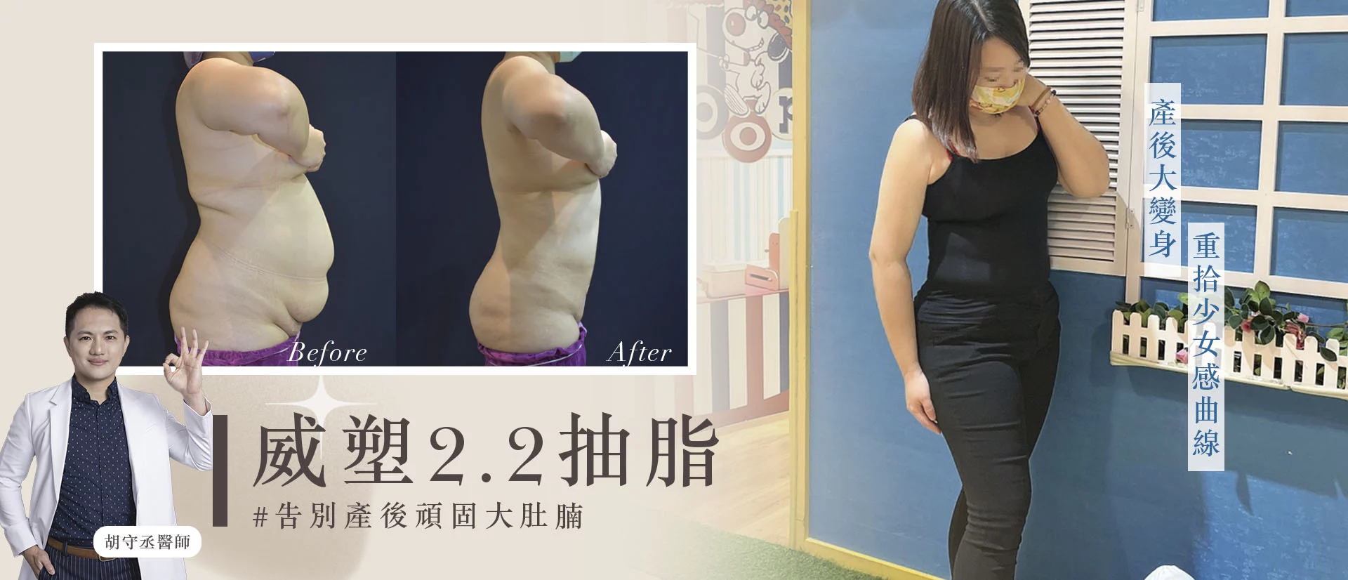 胡守丞醫師-微創威塑抽脂專家-VASER抽脂-新顏診所-腹部環抽