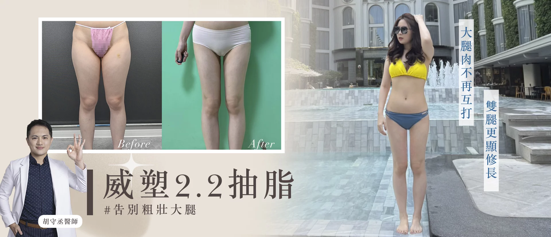 胡守丞醫師-微創威塑抽脂專家-VASER抽脂-新顏診所-大腿環抽
