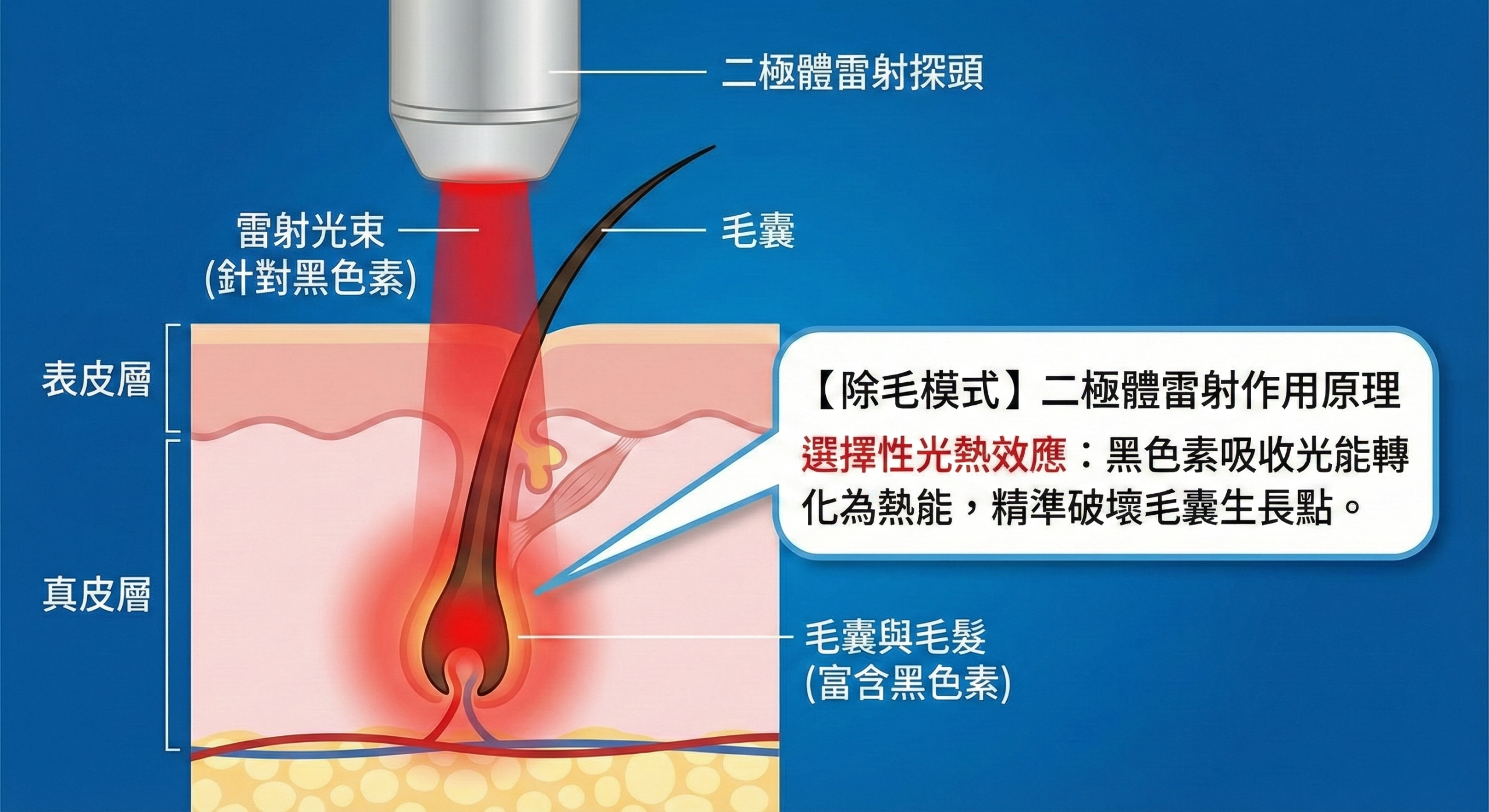 新顏診所_除毛管理模式