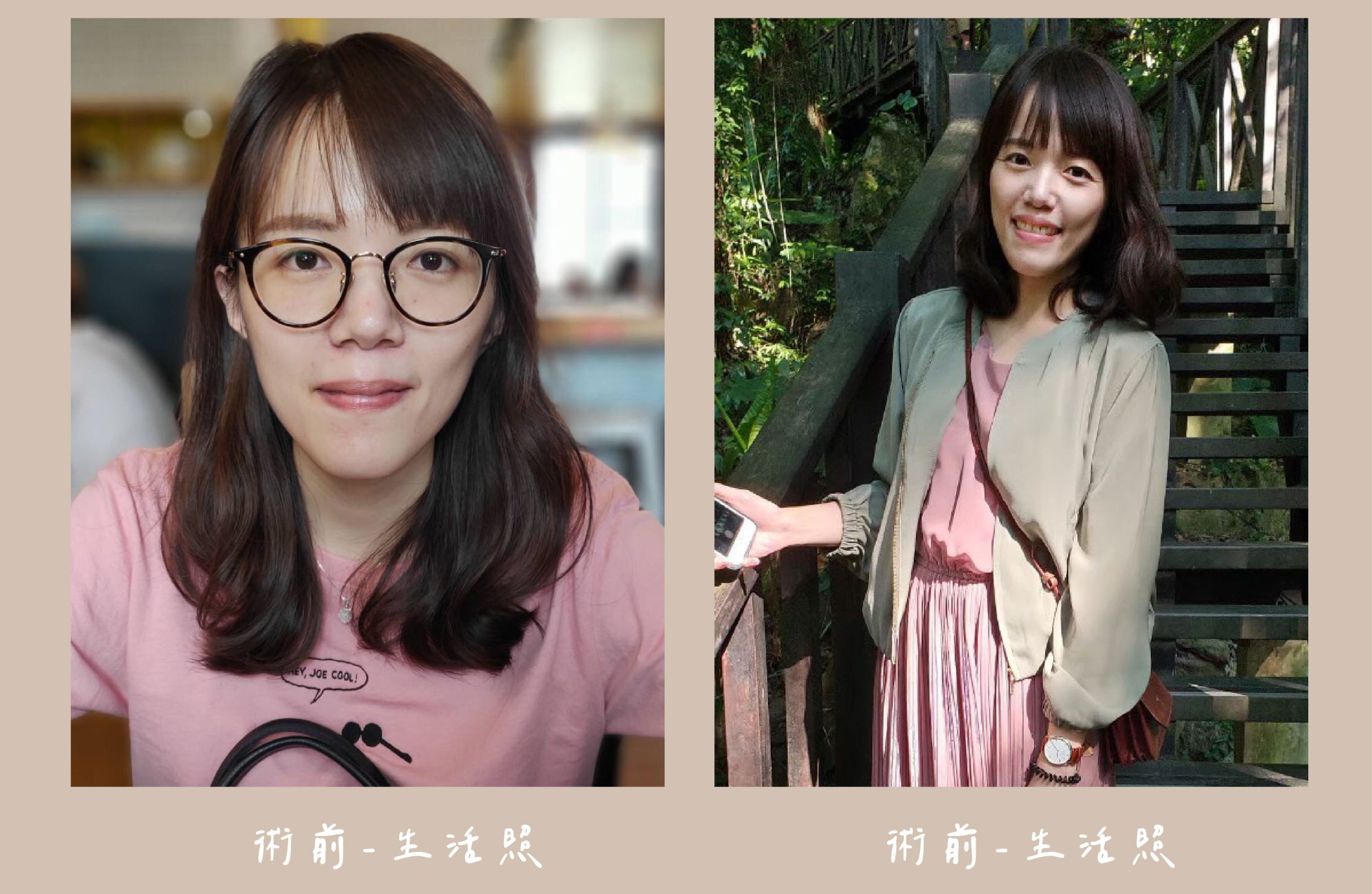 胡守丞醫師-臉部補脂術前生活照