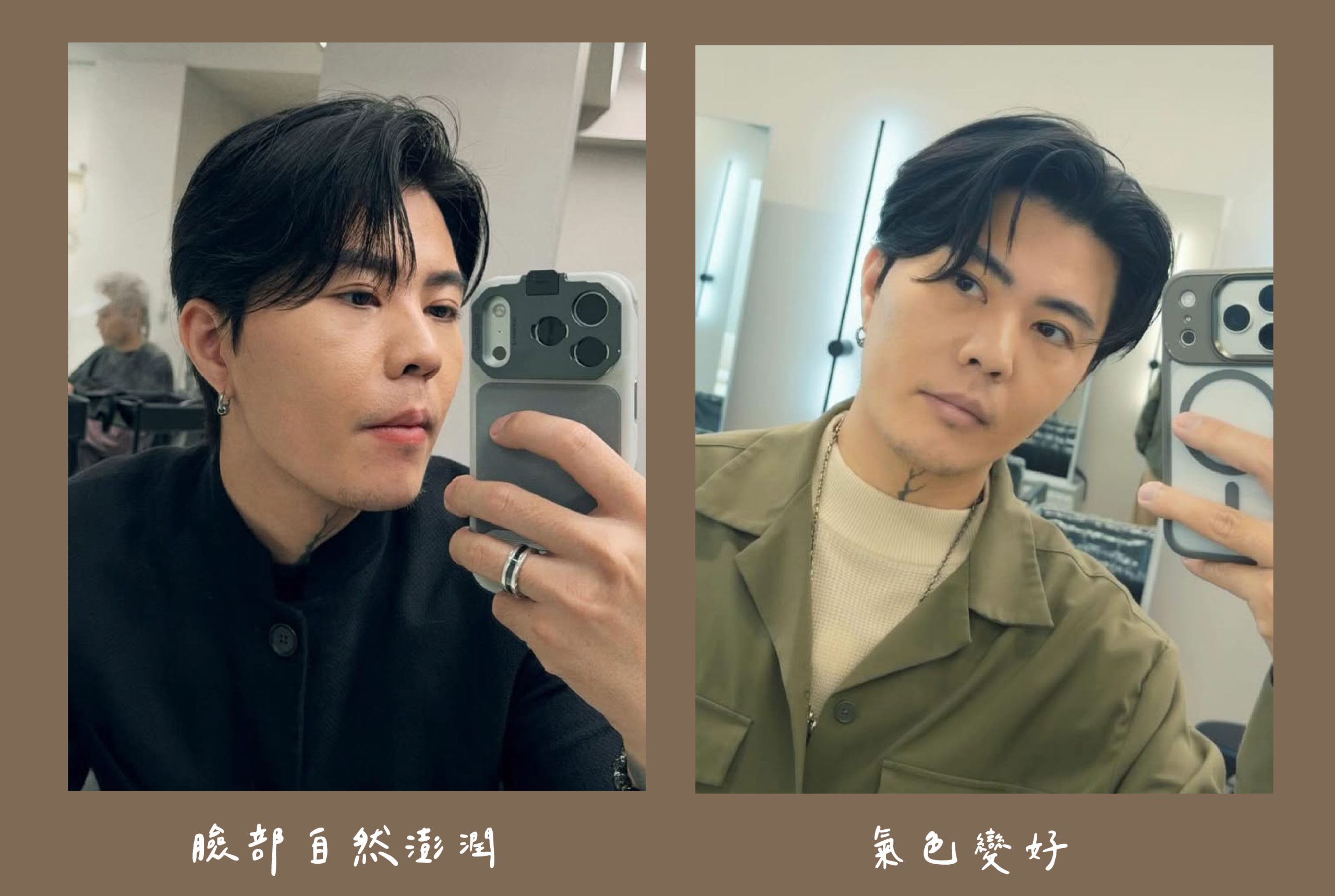 胡守丞醫師-瑞絲朗玻尿酸_術後生活照