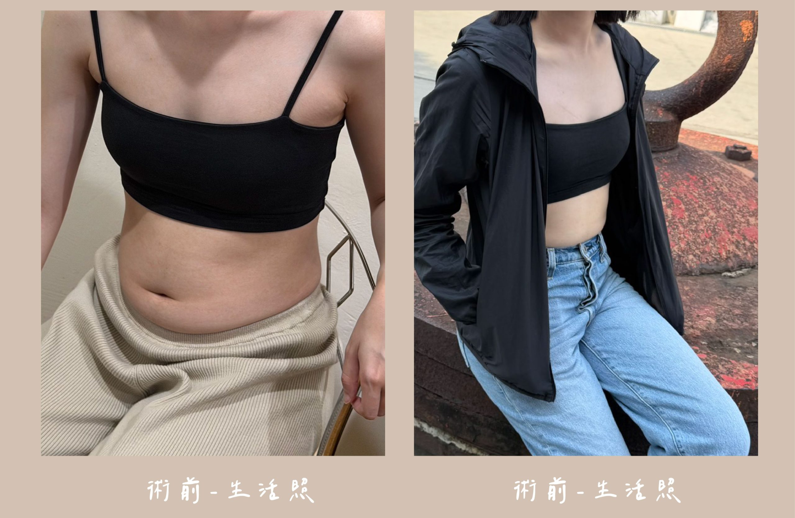 胡守丞院長-音浪脂雕術前生活照