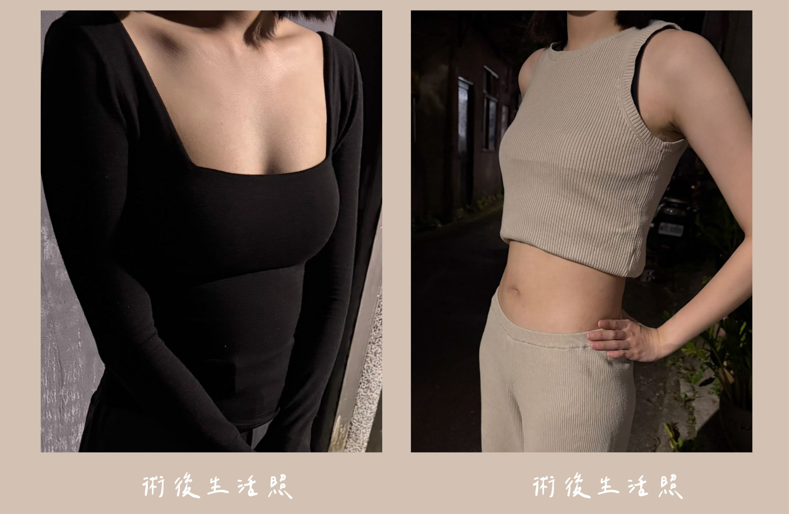 胡守丞院長-音浪脂雕術後生活照