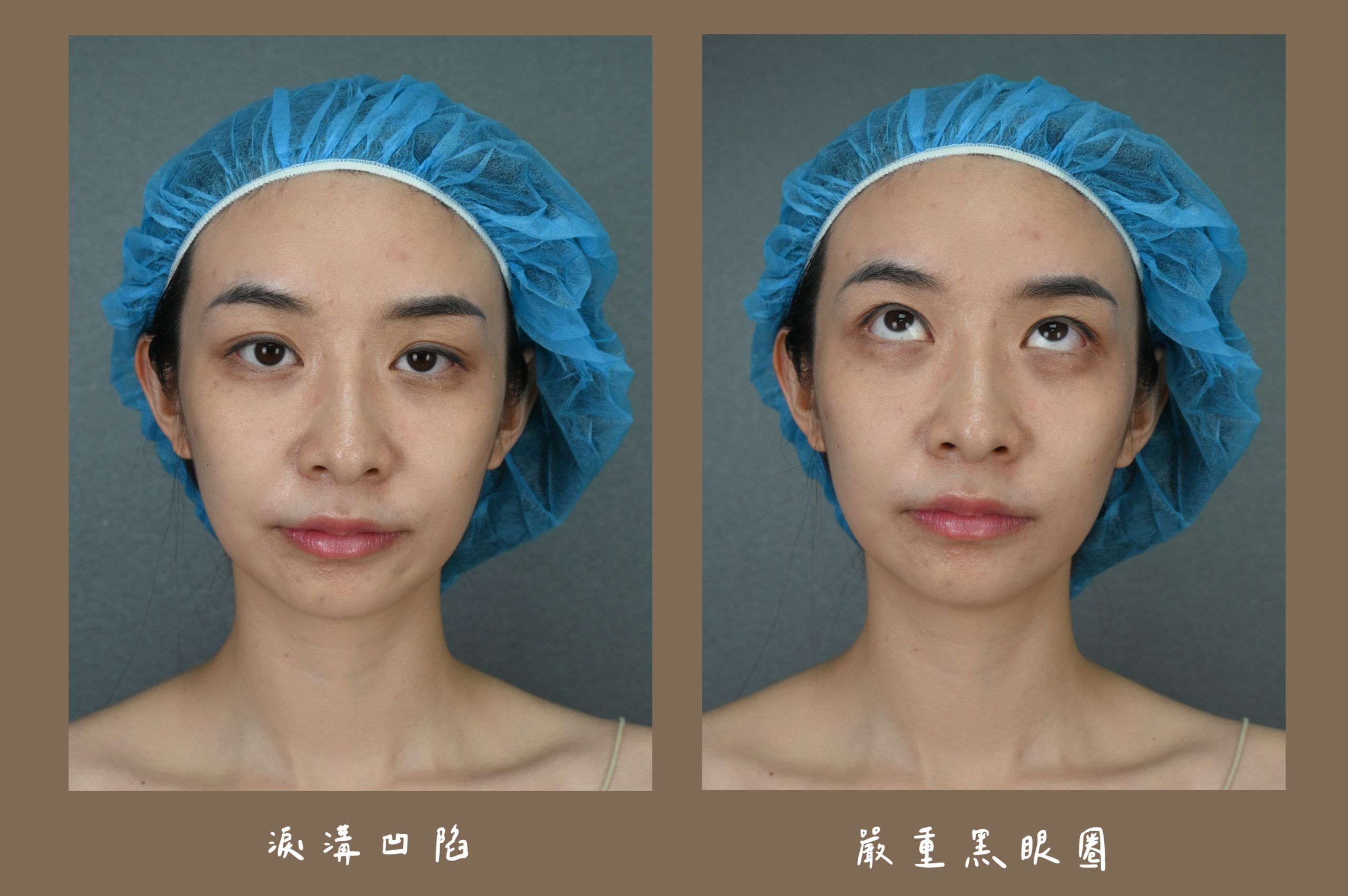 胡守丞醫師-薇貝拉-白童_術前