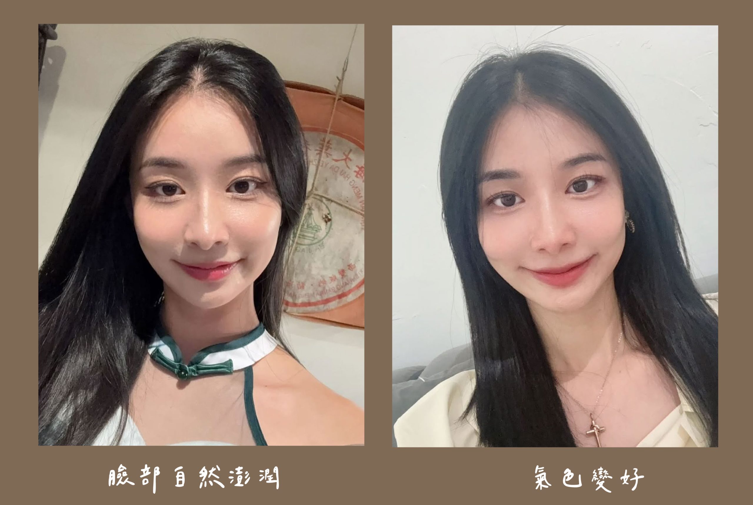 胡守丞醫師-薇貝拉-白童_術後生活照