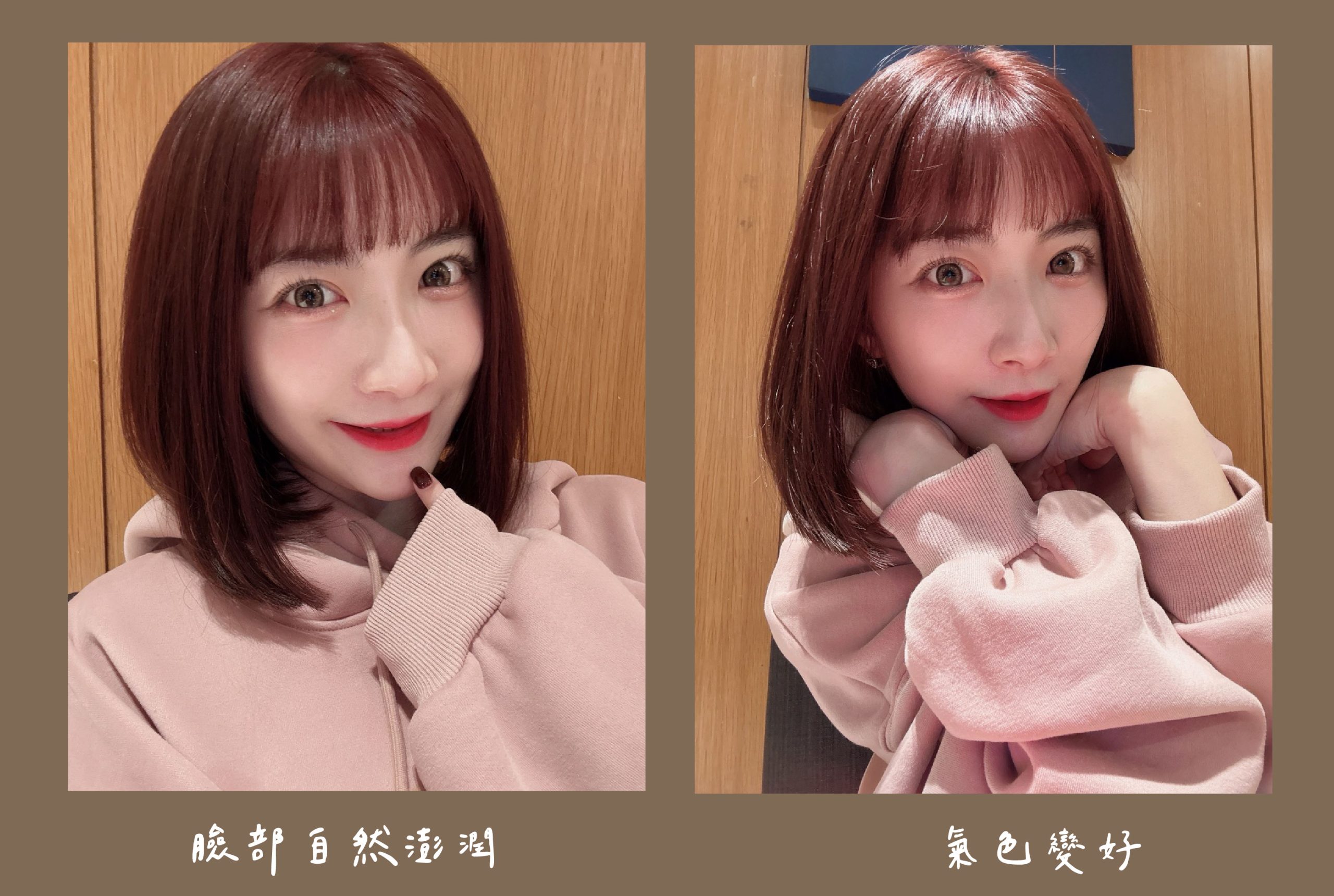 胡守丞醫師-薇貝拉-瑞斯朗玻尿酸_術後生活