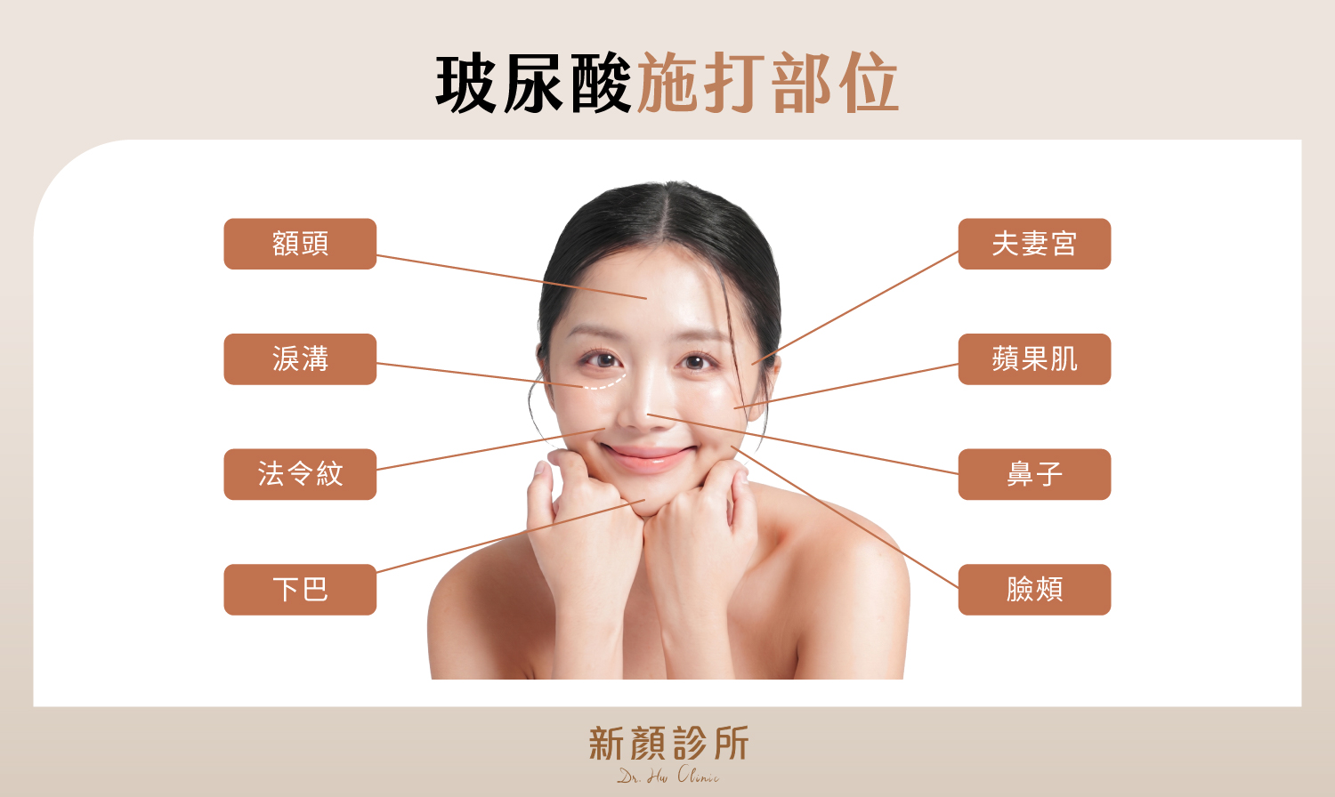 玻尿酸施打部位