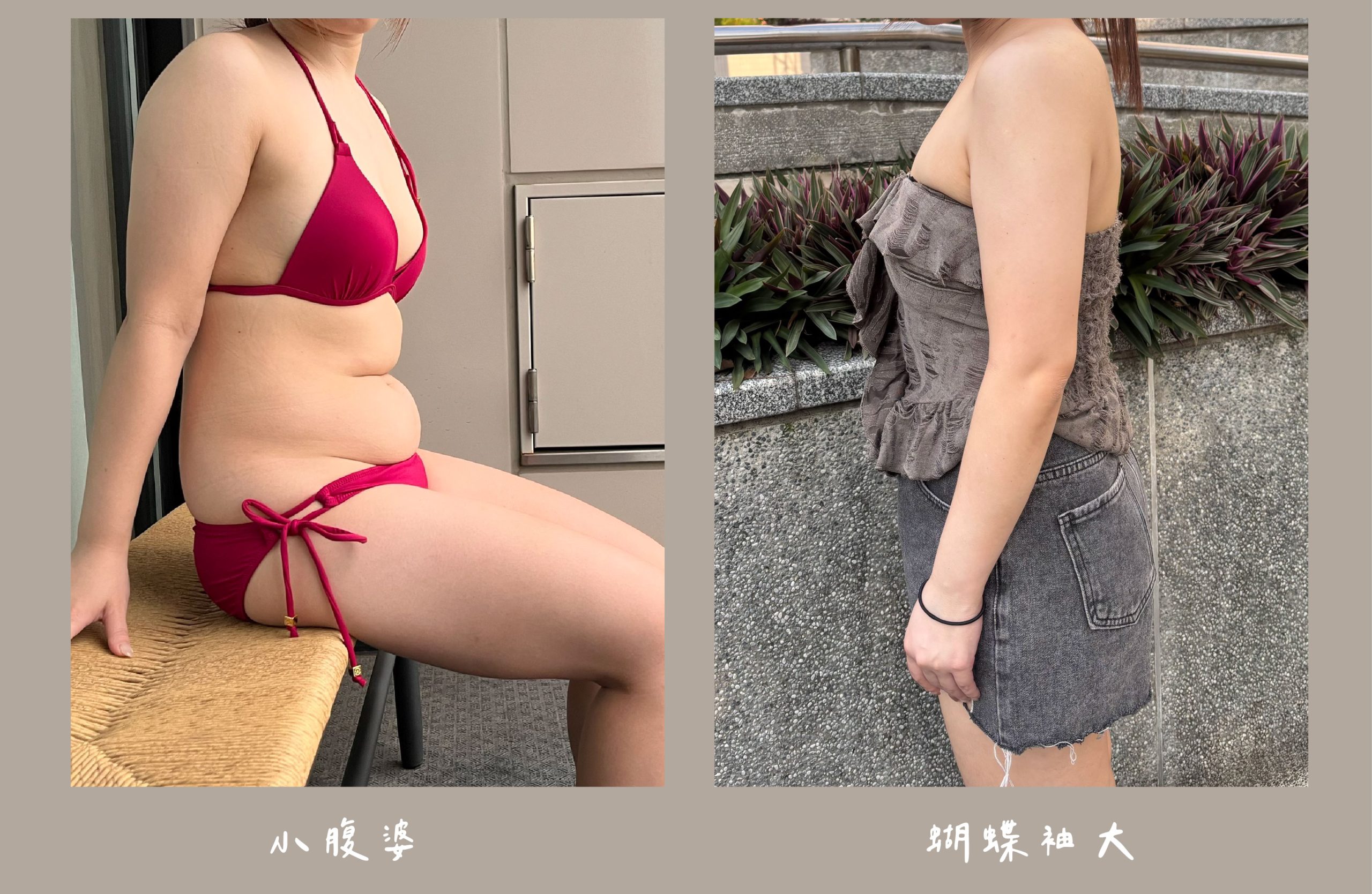 胡守丞院長-威塑2.2抽脂術前生活照