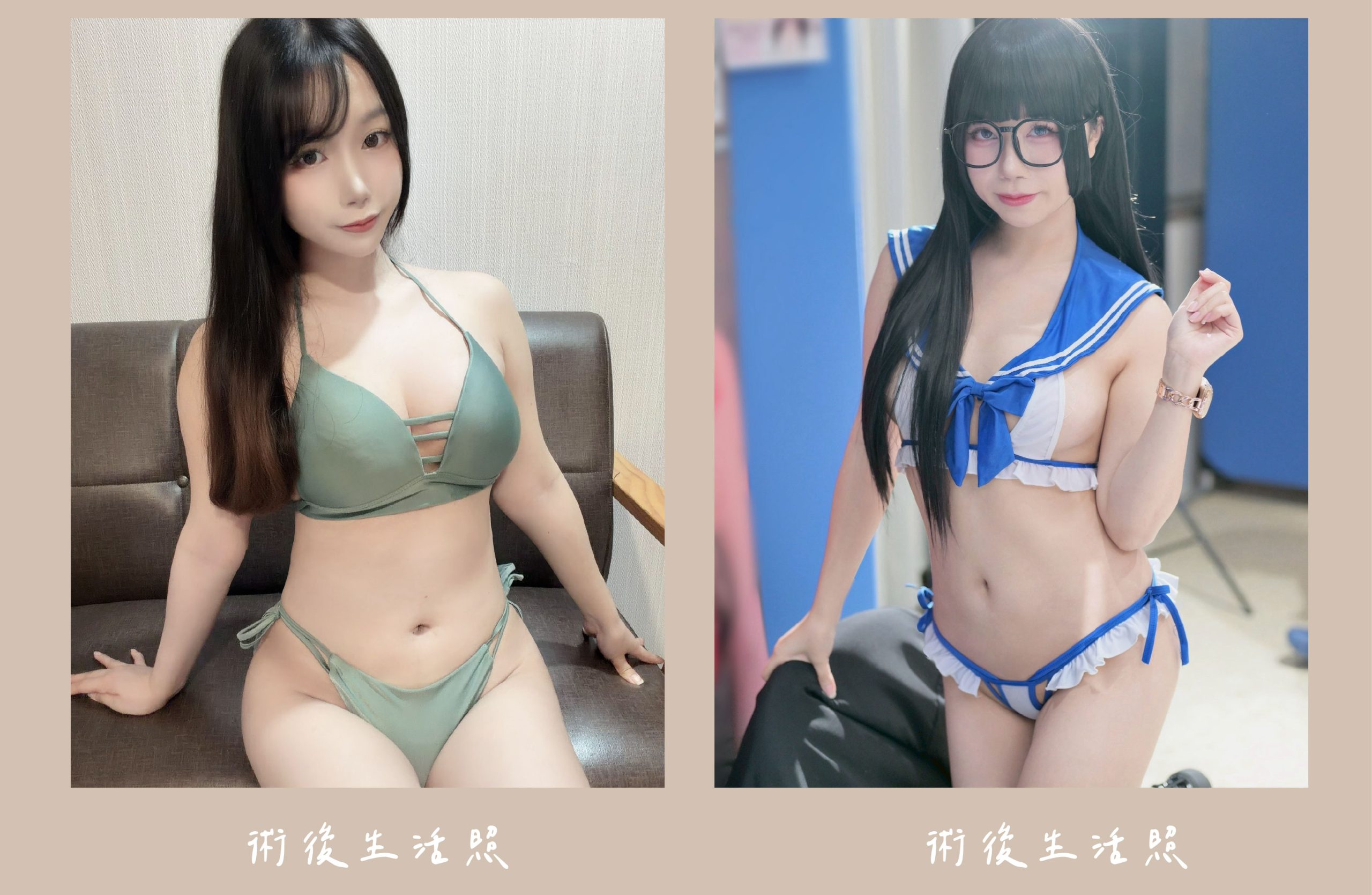 胡守丞院長-威塑2.2抽脂自體脂肪補胸+腹部環抽術後生活照