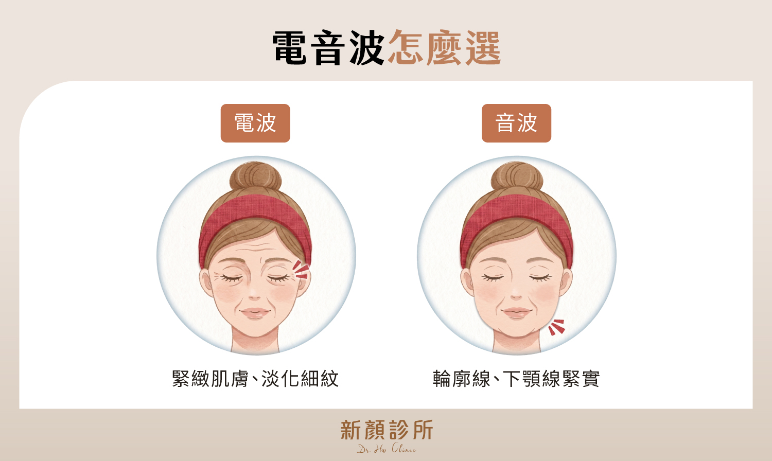 電波緊緻肌膚與淡化細紋,音波緊實輪廓線與下顎線